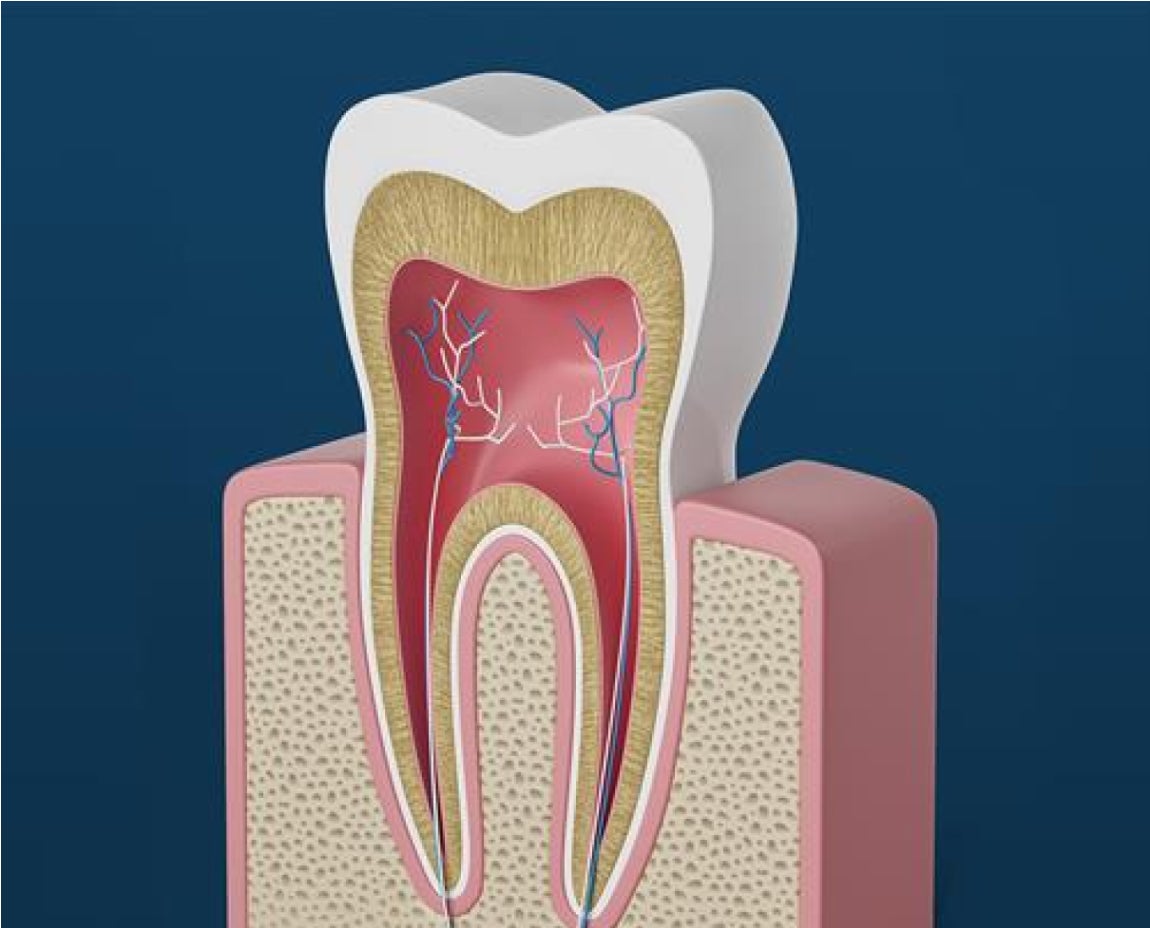 Root Canal Treatment